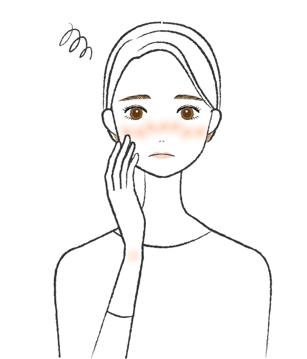 赤ら顔（酒さ）