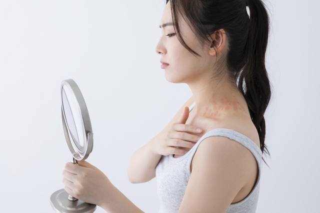 アレルギー科のご案内